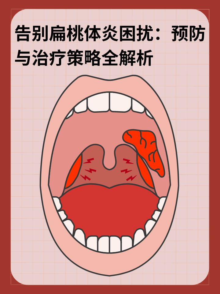 👉告别扁桃体炎困扰：预防与治疗策略全解析