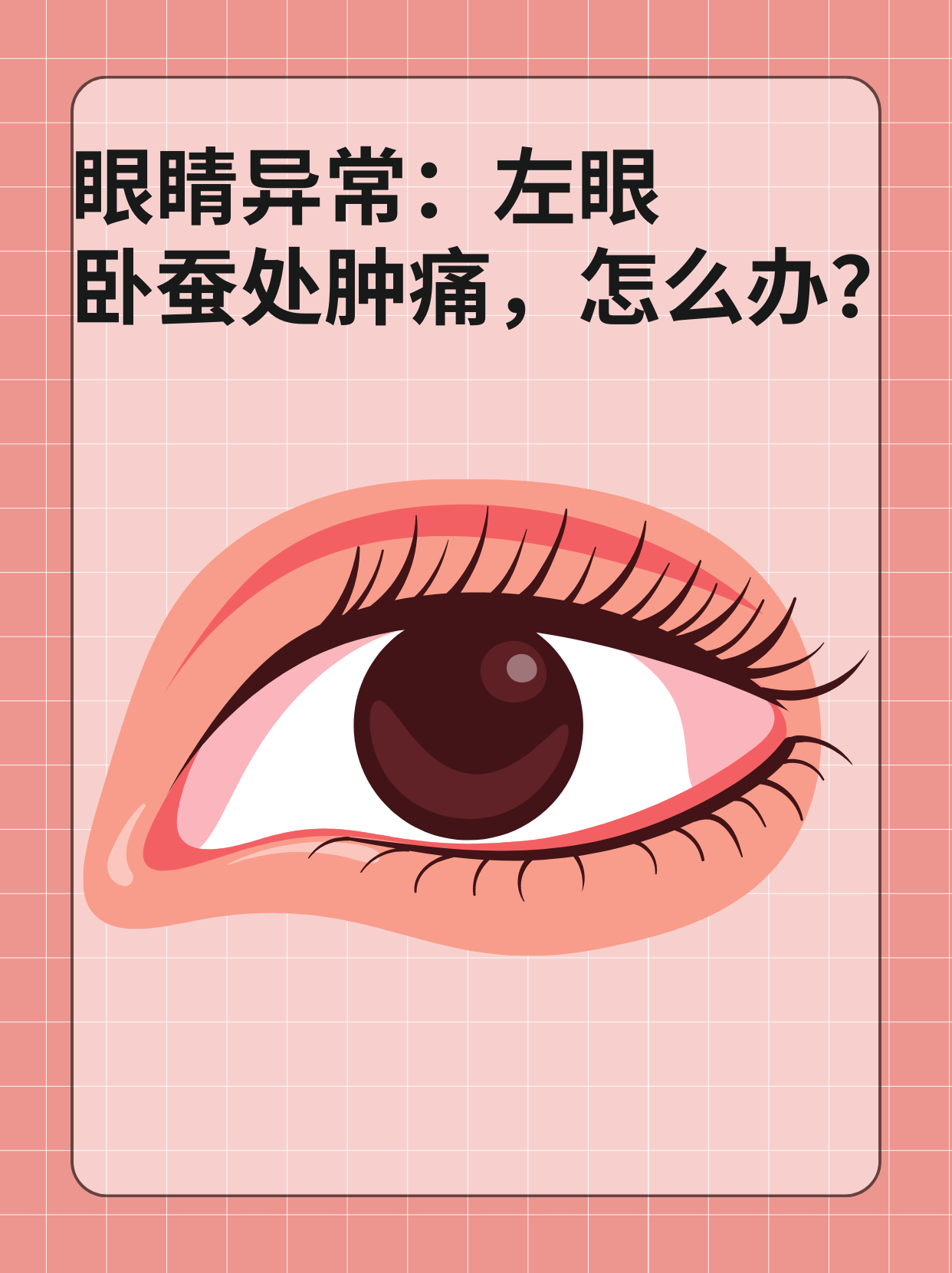 👉眼睛异常：左眼卧蚕处肿痛，怎么办？