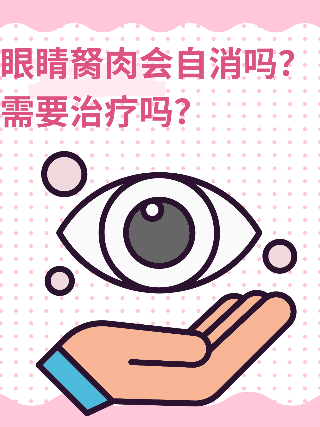 👉眼睛胬肉会自消吗？需要治疗吗？