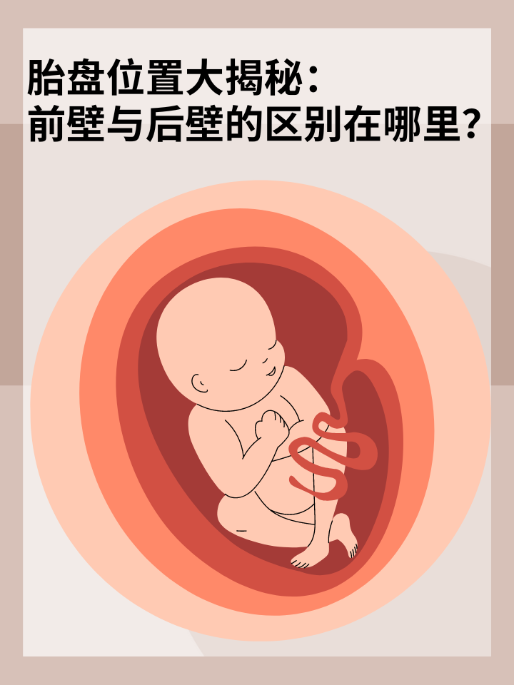 👉胎盘位置大揭秘：前壁与后壁的区别在哪里？