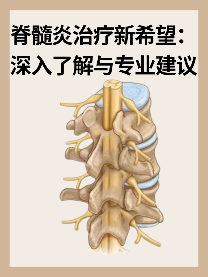 👉脊髓炎治疗新希望：深入了解与专业建议