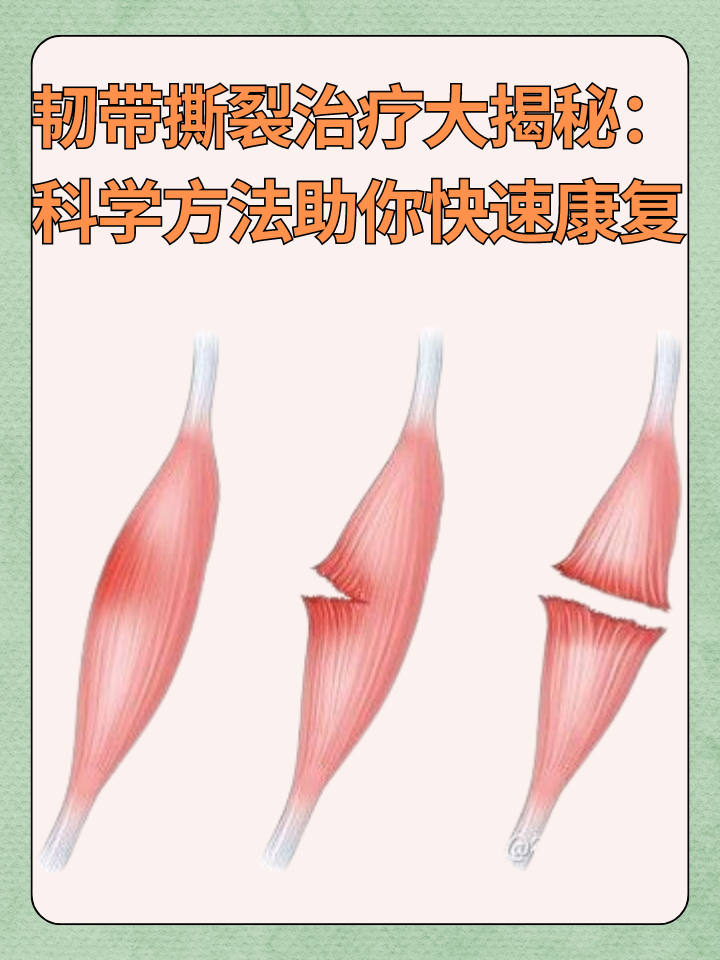 👉韧带撕裂治疗大揭秘：科学方法助你快速康复