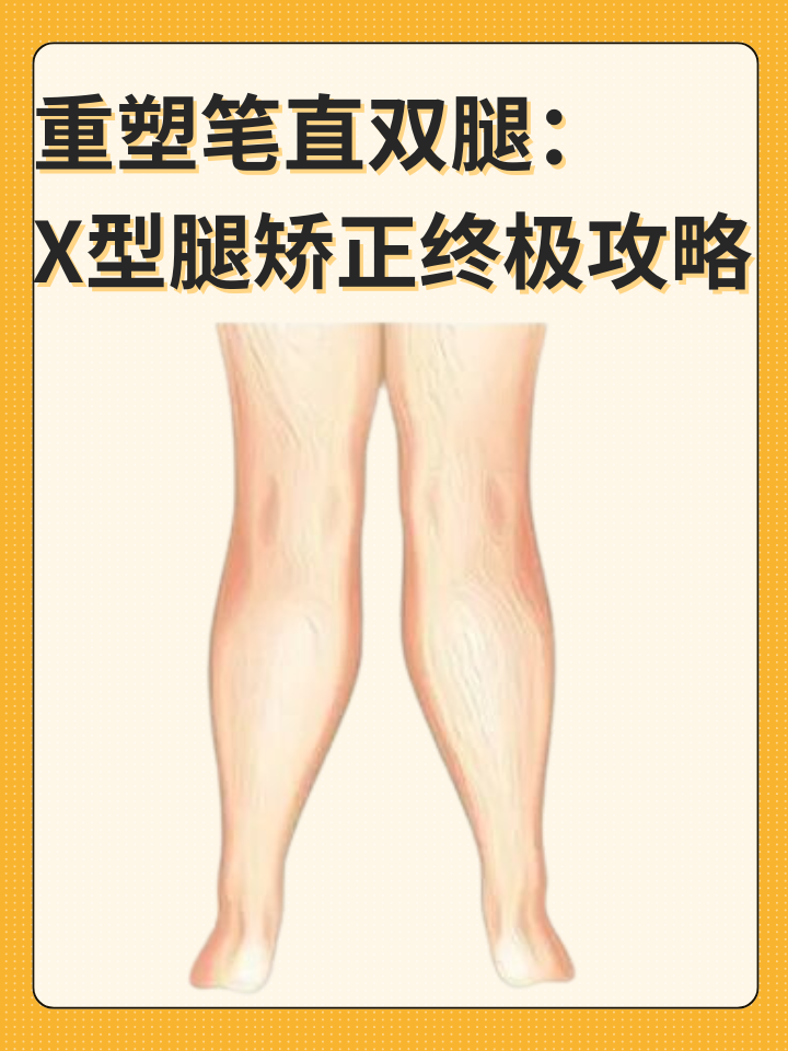 👉重塑笔直双腿：X型腿矫正终极攻略