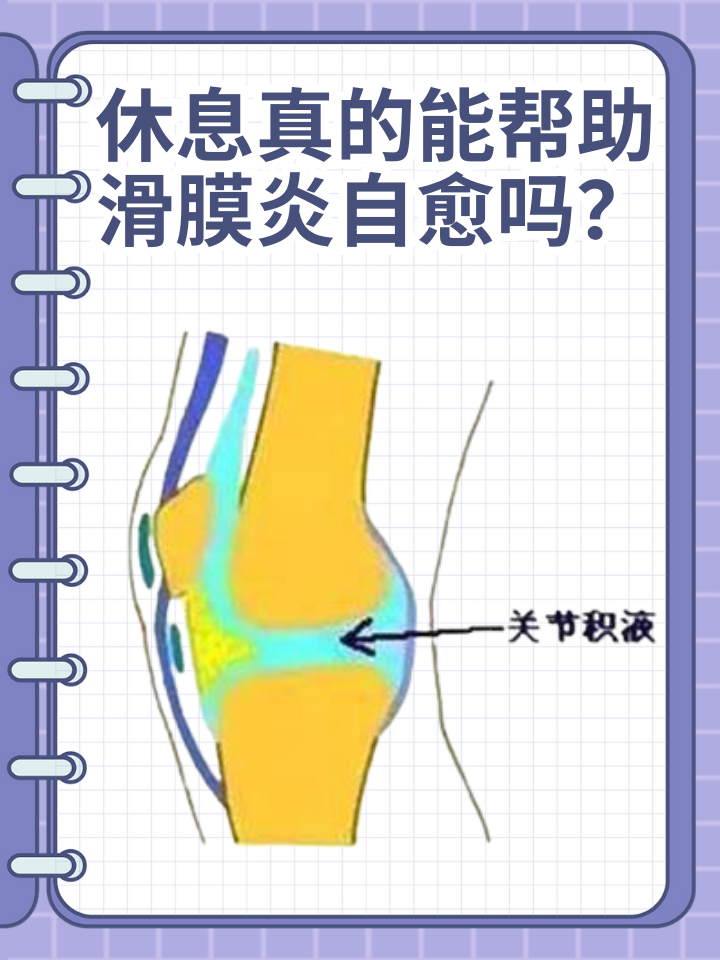 👉休息真的能帮助滑膜炎自愈吗？