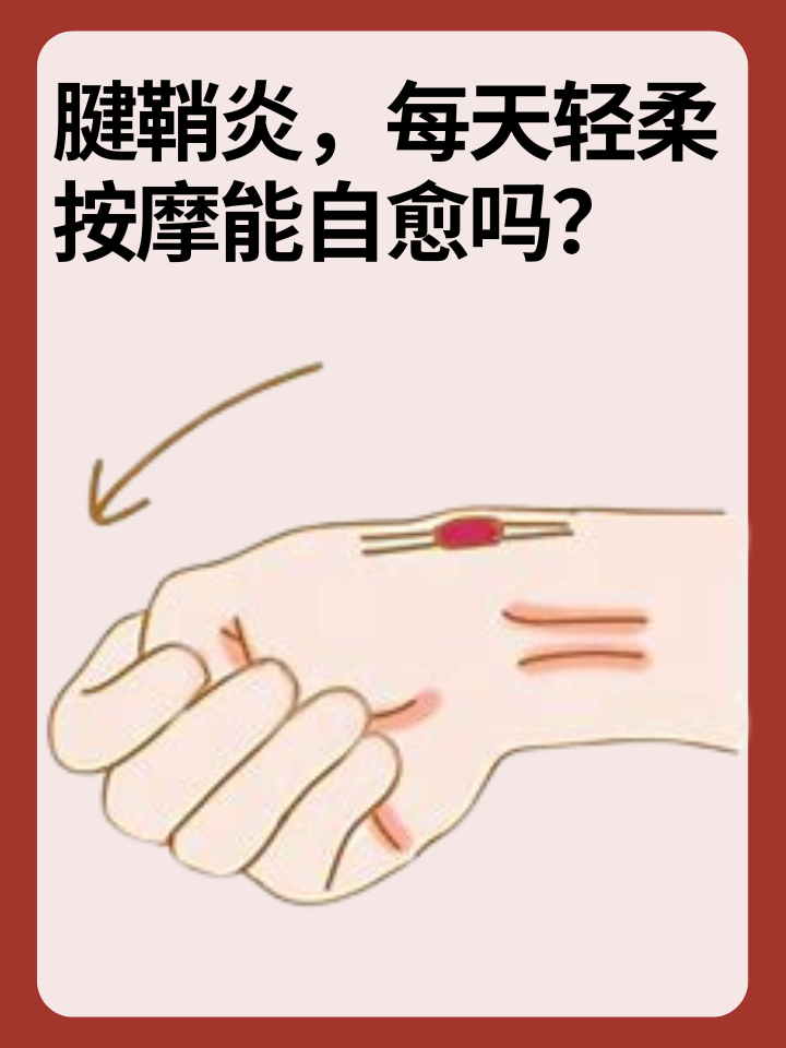 👉腱鞘炎，每天轻柔按摩能自愈吗？