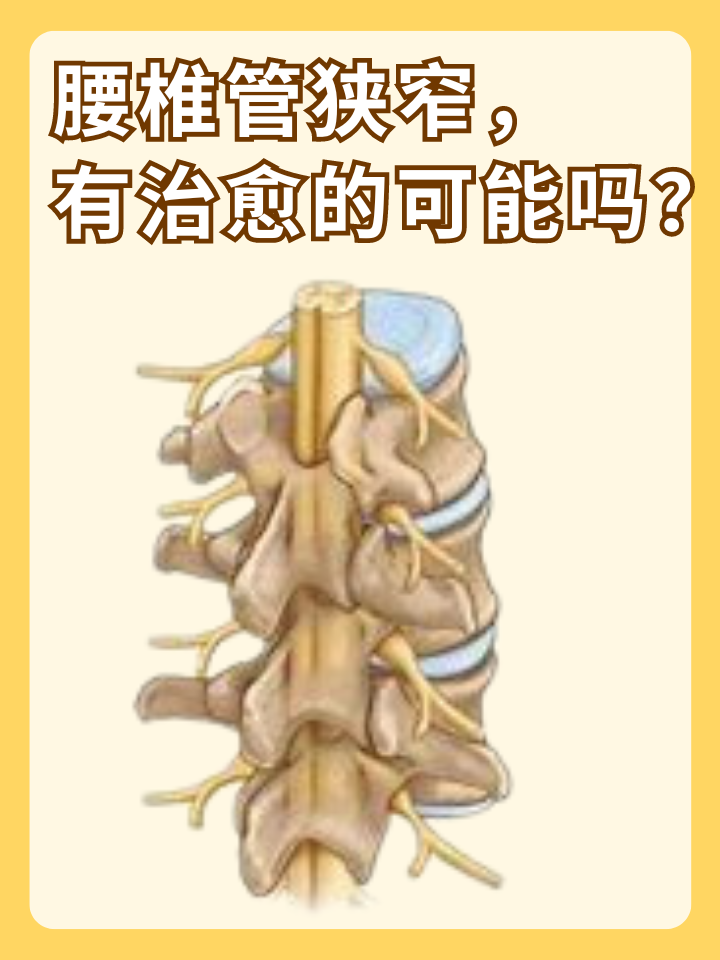 👉腰椎管狭窄，有治愈的可能吗？