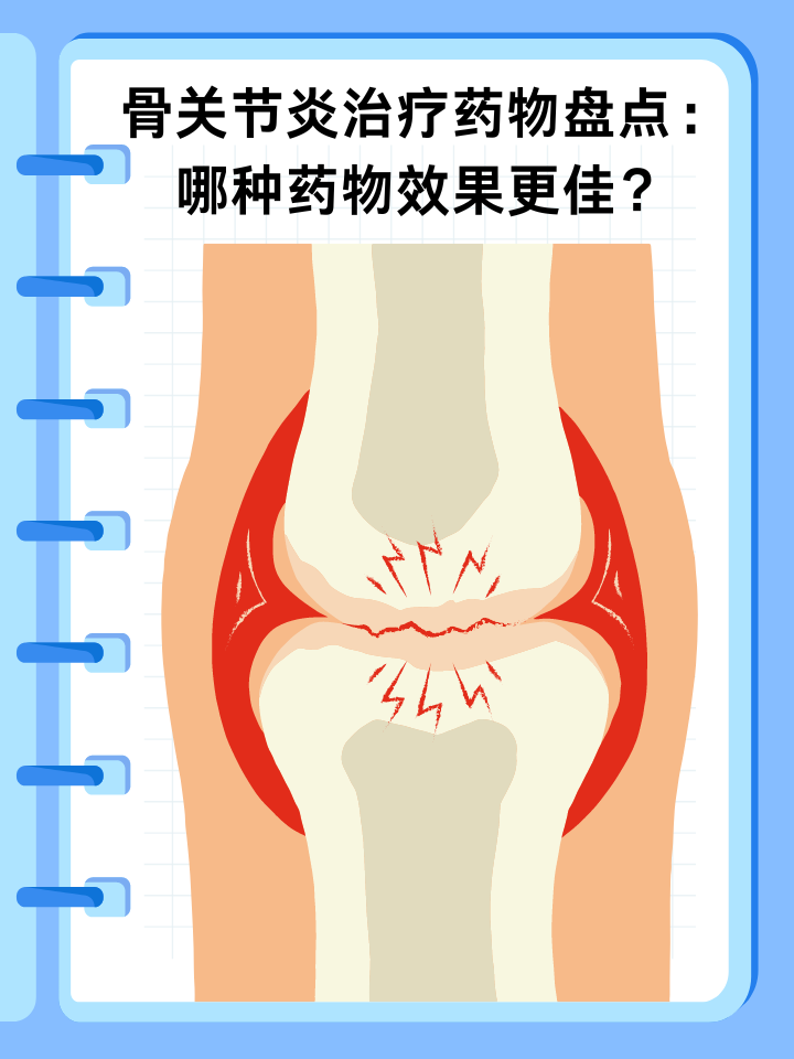 👉骨关节炎治疗药物盘点：哪种药物效果更佳？