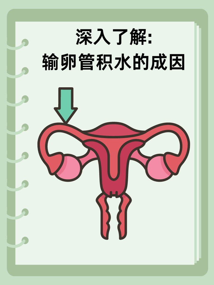 👉深入了解:输卵管积水的成因