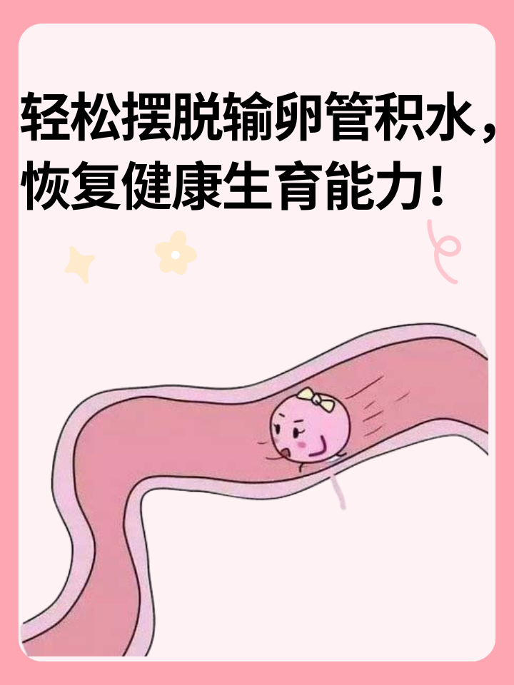 👉轻松摆脱输卵管积水， 恢复健康生育能力！