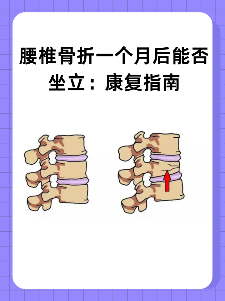 👉腰椎骨折一个月后能否坐立：康复指南