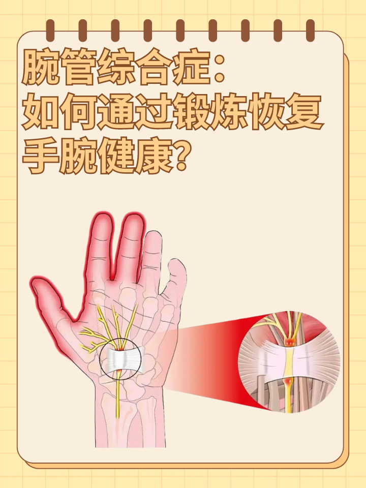 👉腕管综合症：如何通过锻炼恢复手腕健康？