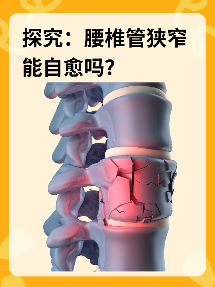 👉探究：腰椎管狭窄能自愈吗？