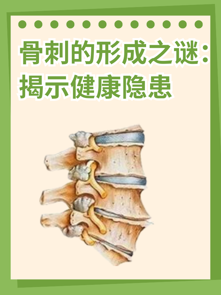 👉骨刺的形成之谜：揭示健康隐患