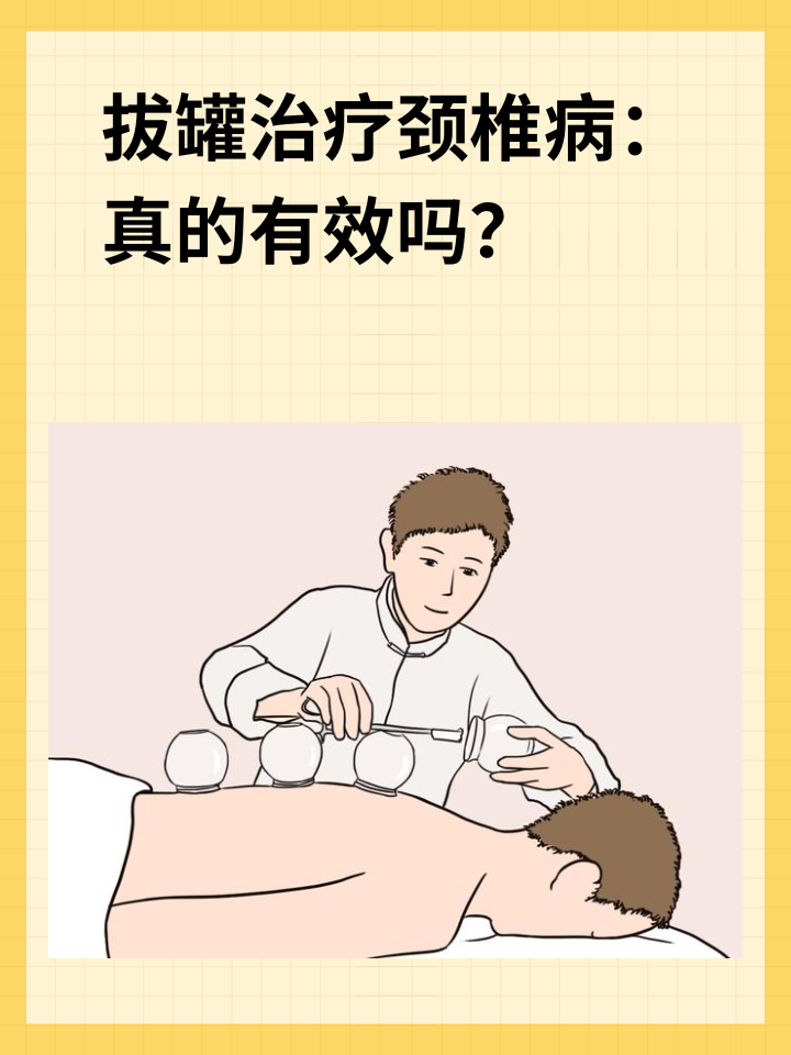 👉拔罐治疗颈椎病：真的有效吗？