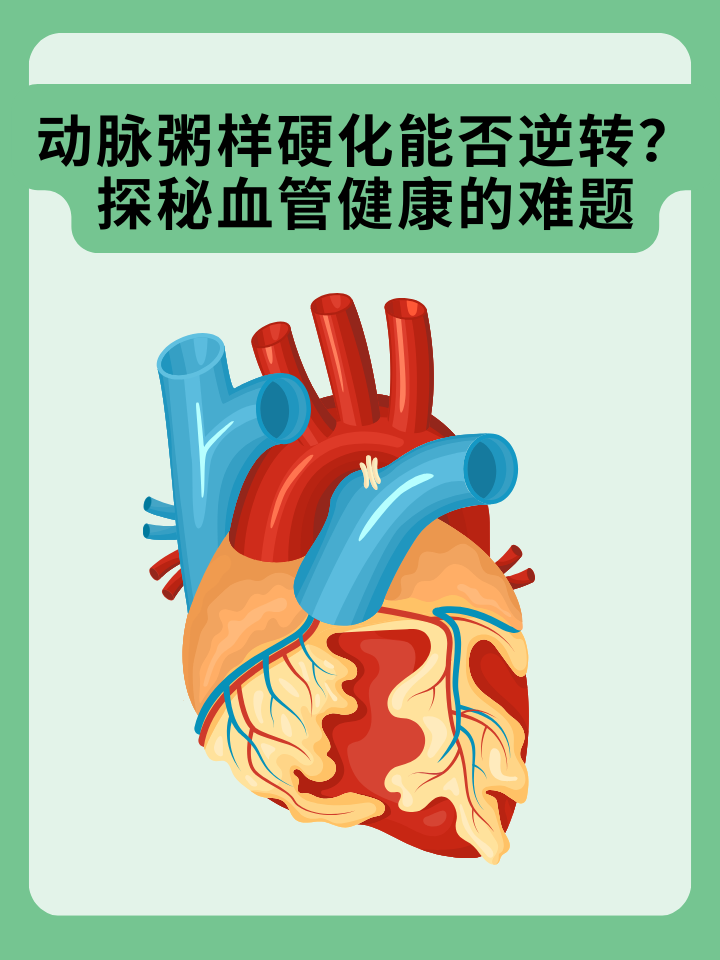 👉动脉粥样硬化能否逆转？探秘血管健康的难题