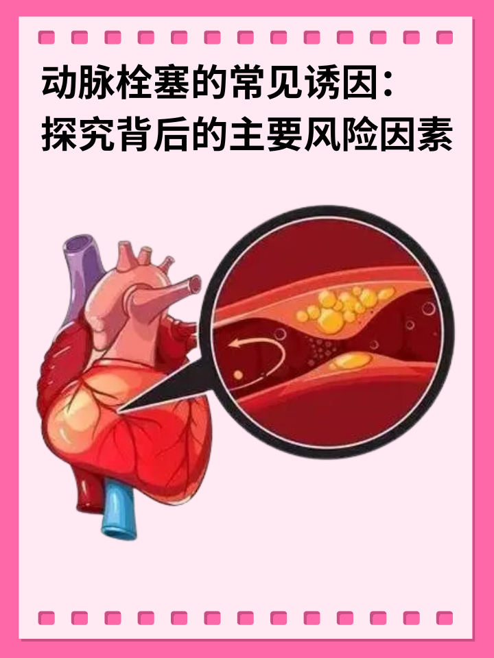 👉动脉栓塞的常见诱因：探究背后的主要风险因素