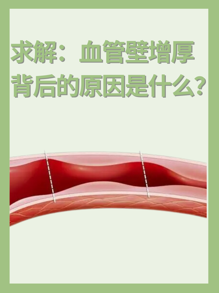 👉求解：血管壁增厚背后的原因是什么？