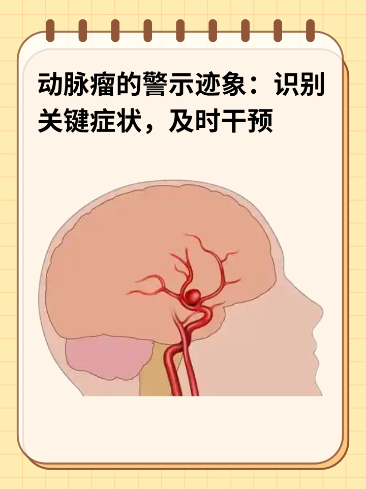 👉动脉瘤的警示迹象：识别关键症状，及时干预