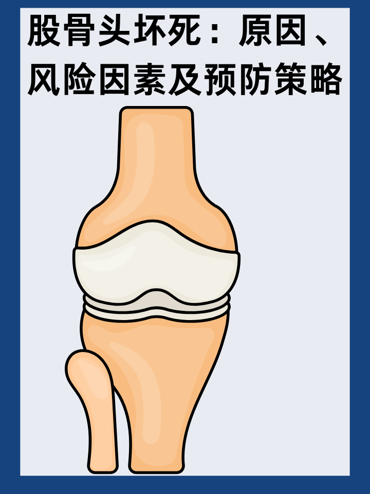 👉股骨头坏死：原因、风险因素及预防策略