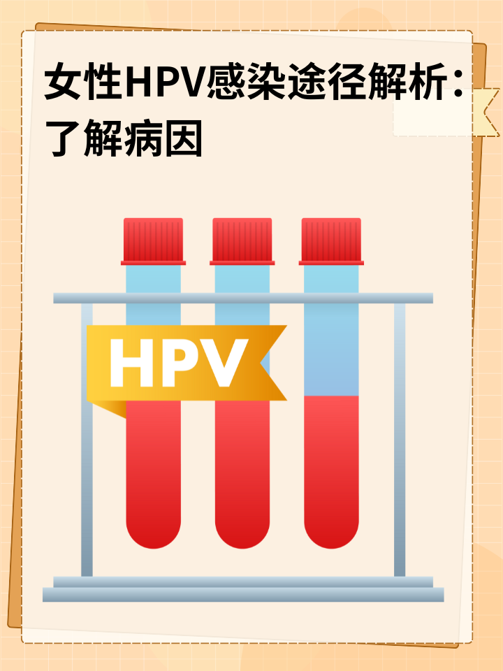 女性HPV感染途径解析：了解病因