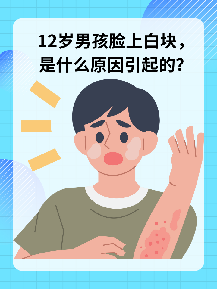 12岁男孩脸上白块，是什么原因引起的？