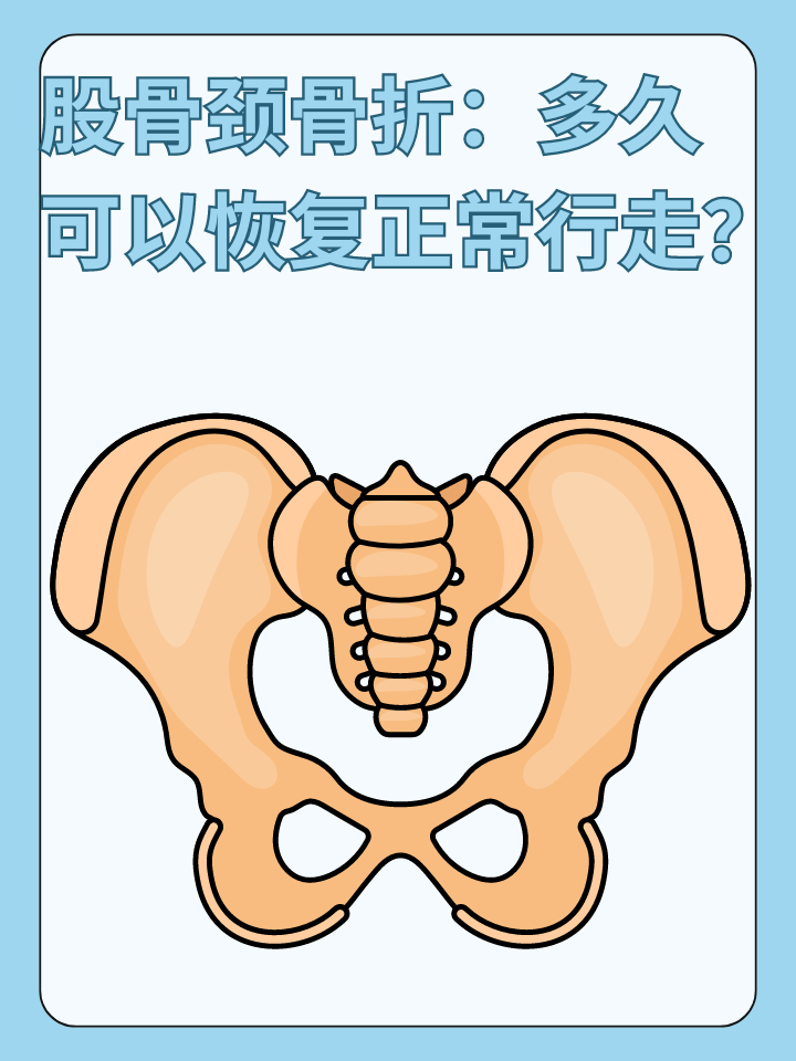 👉股骨颈骨折：多久可以恢复正常行走？