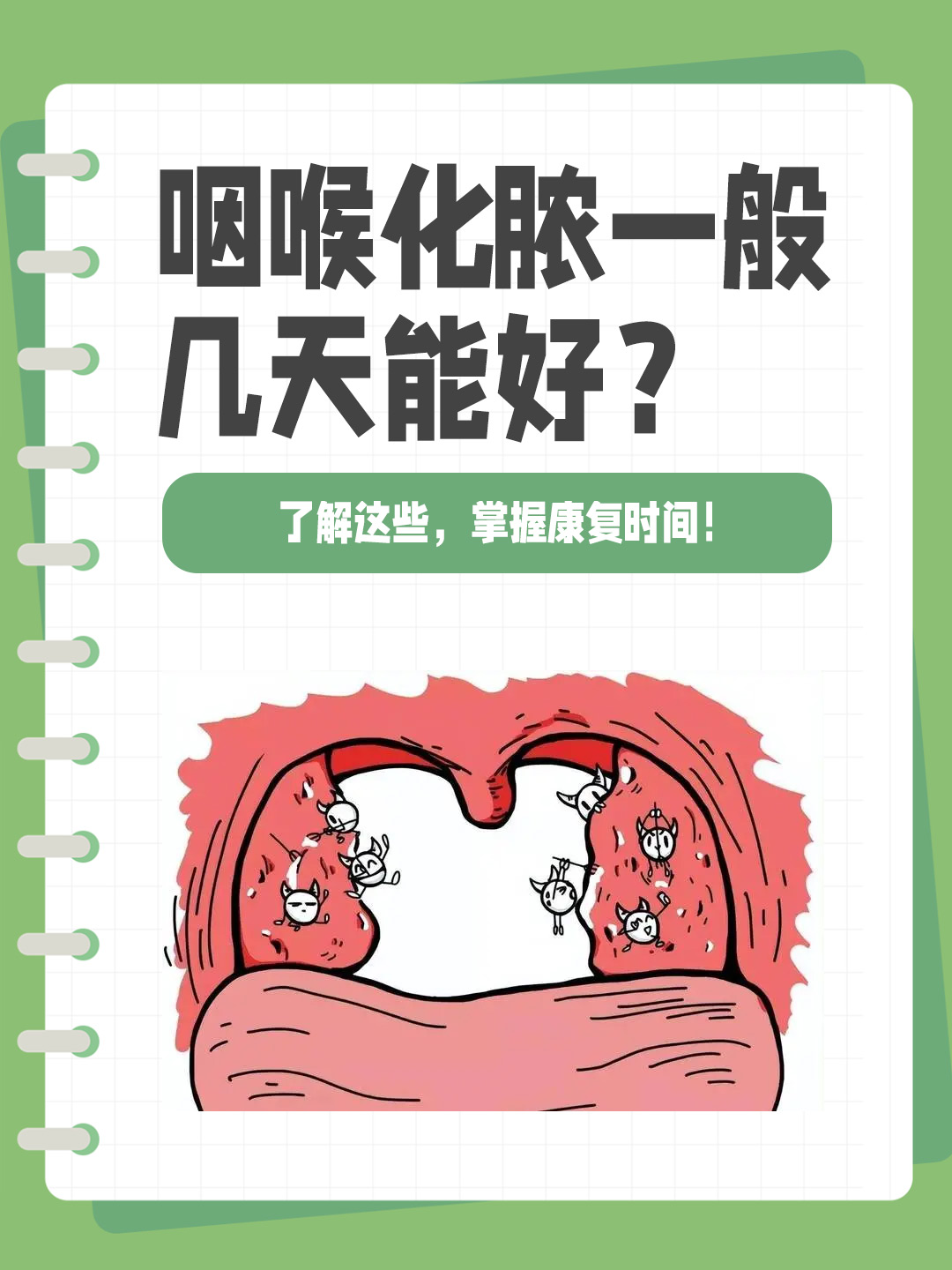 👉咽喉化脓一般几天能好？了解这些，掌握康复时间！