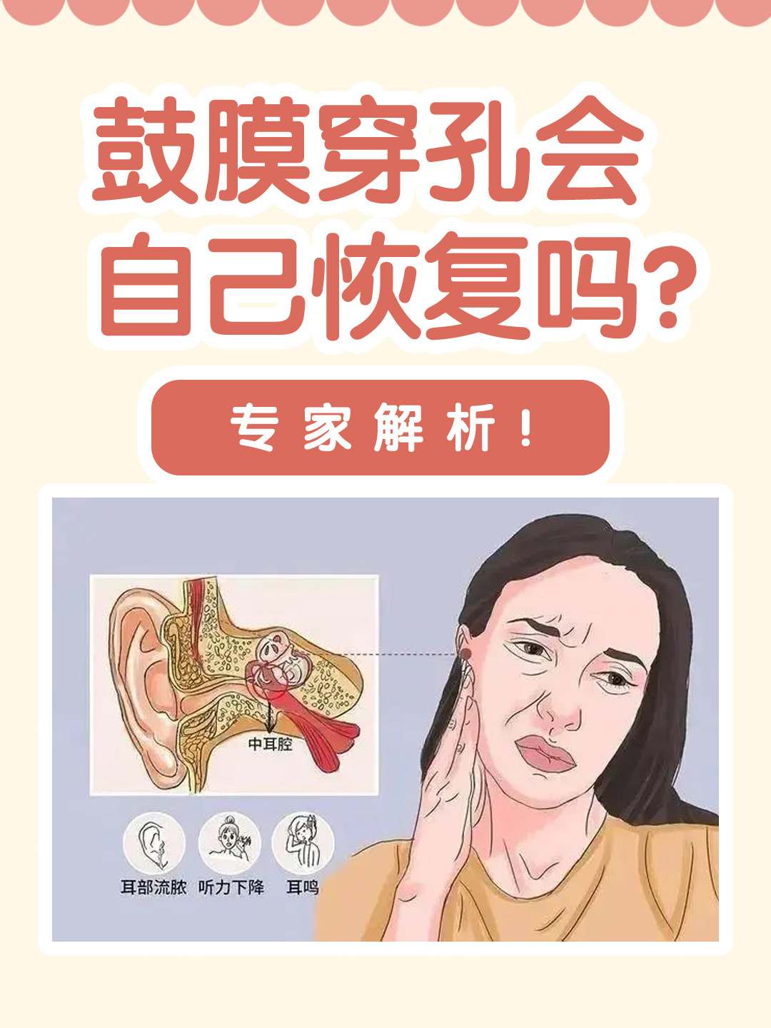 👉鼓膜穿孔会自己恢复吗？专家解析！