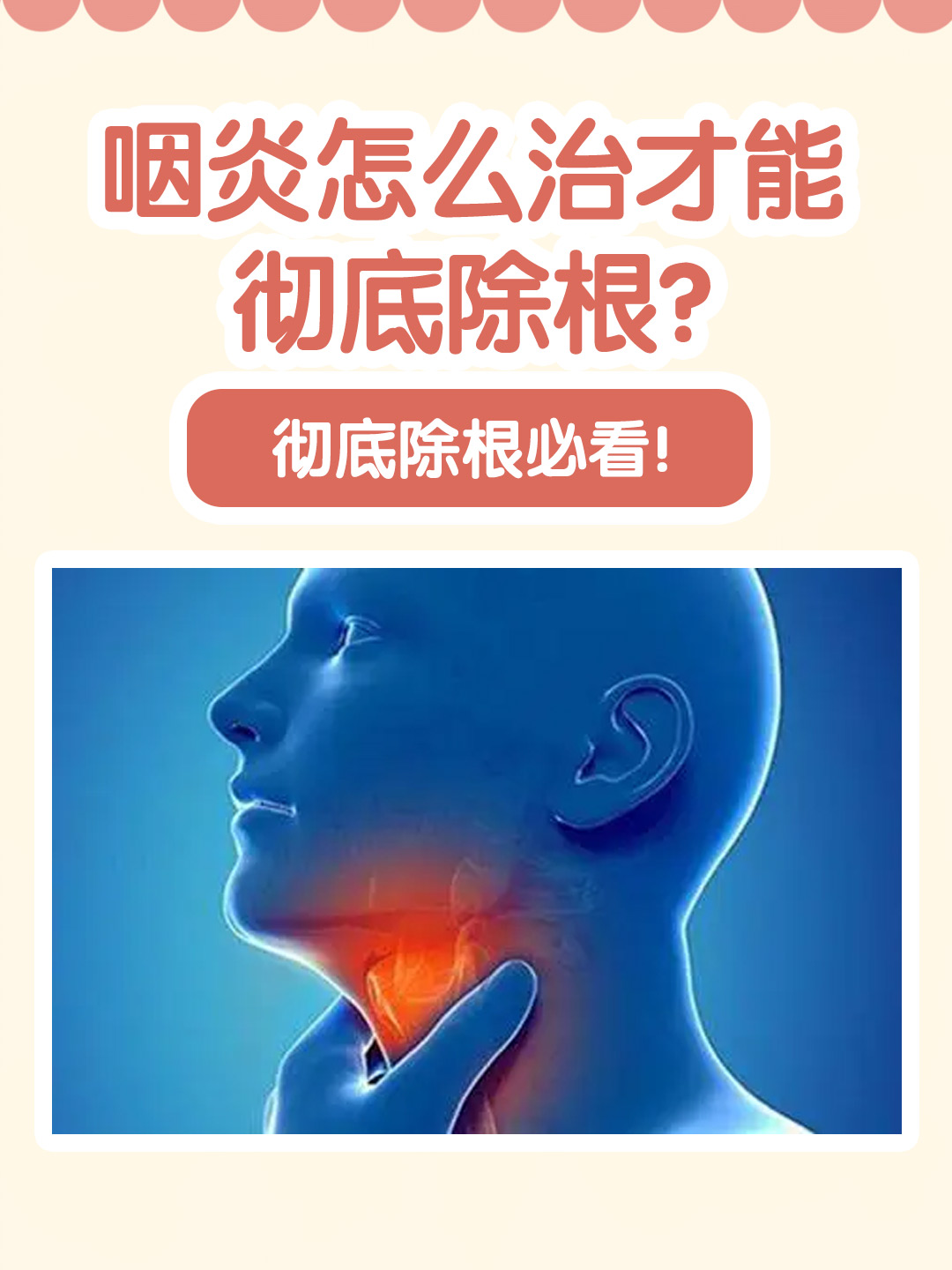 👉 咽炎怎么治才能彻底除根？彻底除根必看！