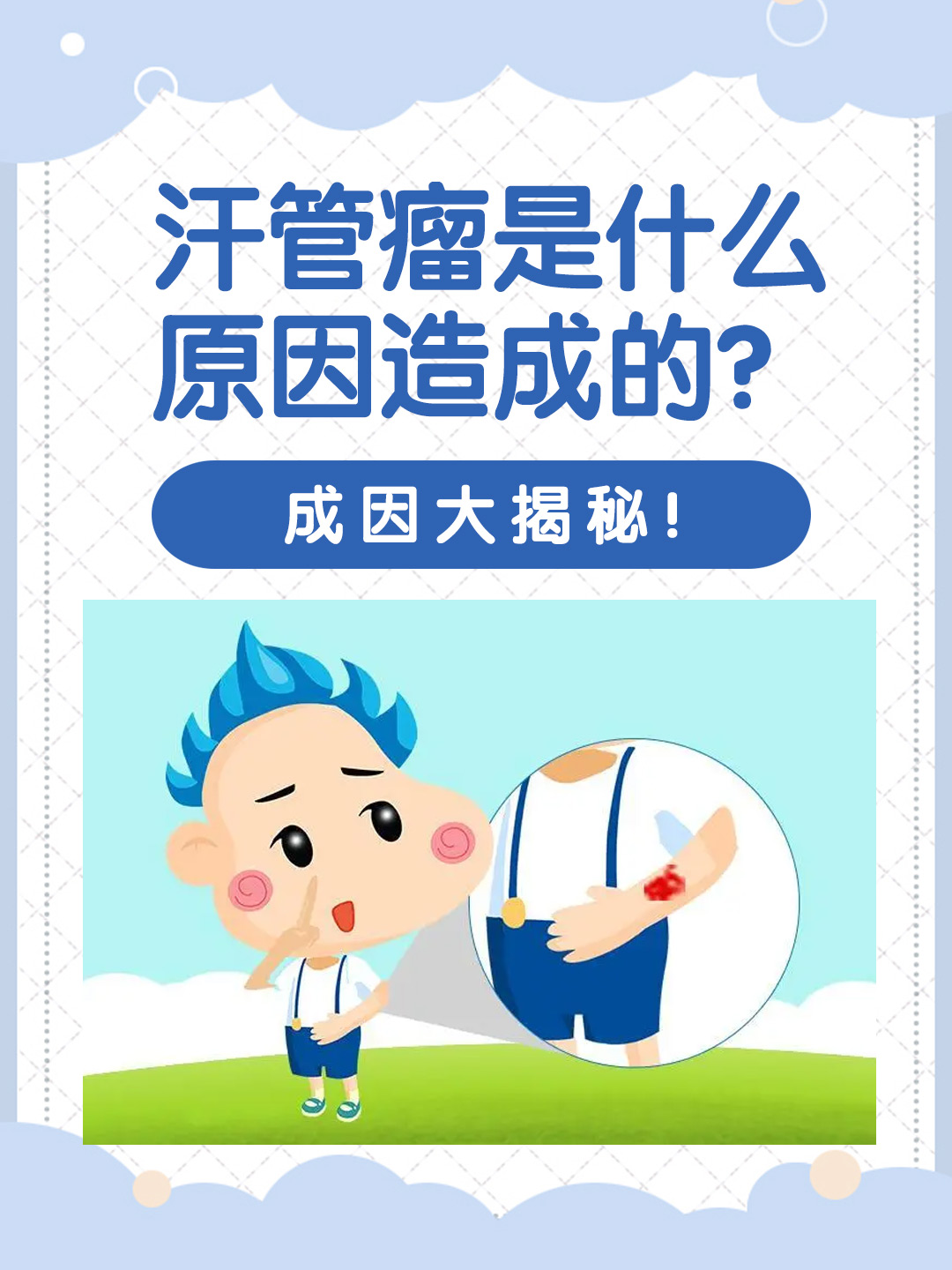 👉汗管瘤是什么原因造成的？成因大揭秘！