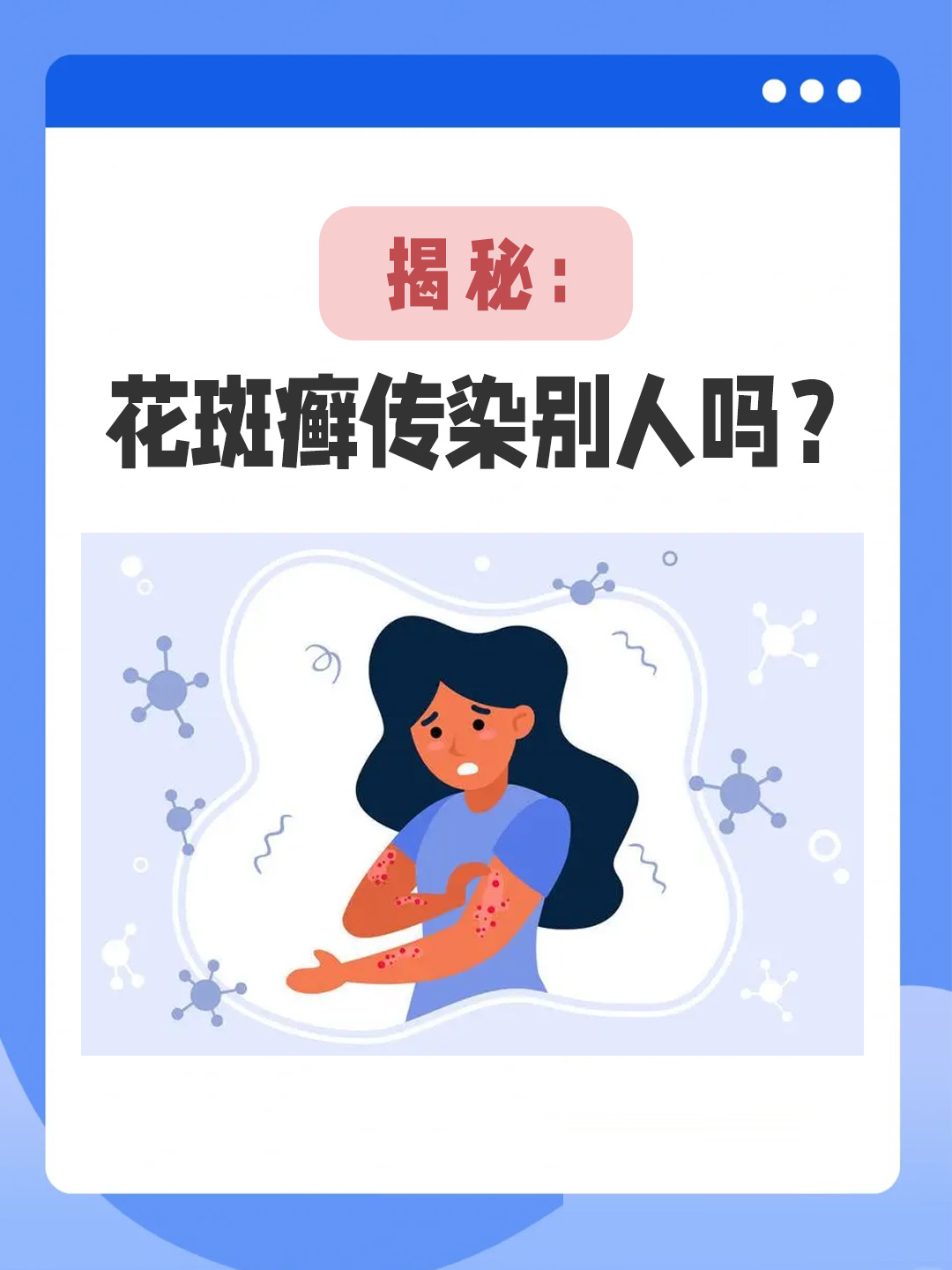 👉揭秘：花斑癣传染别人吗？