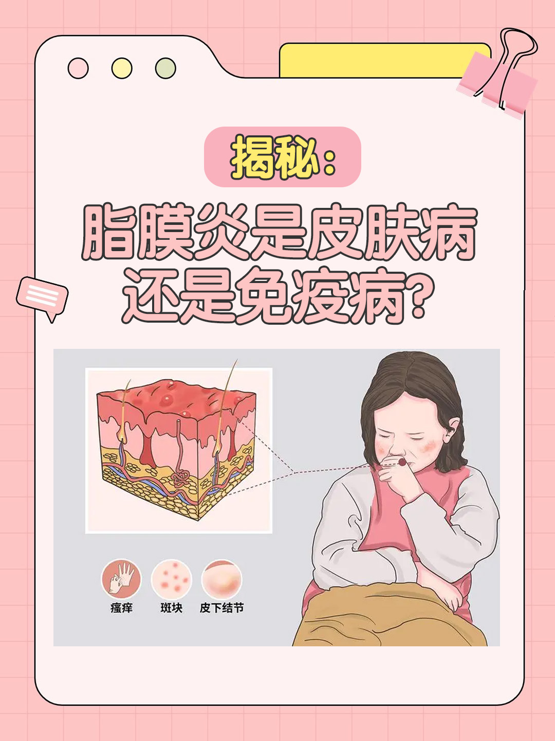 👉揭秘：脂膜炎是皮肤病还是免疫病？