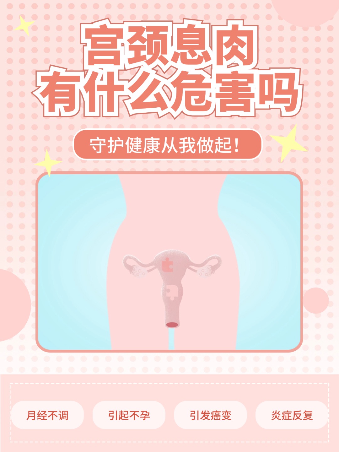 👉宫颈息肉有什么危害吗？女性必看，守护健康从我做起！