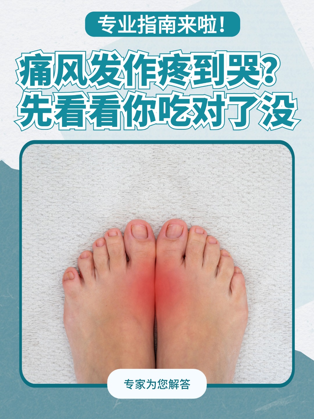 痛风发作疼到哭？先看看你吃对了没