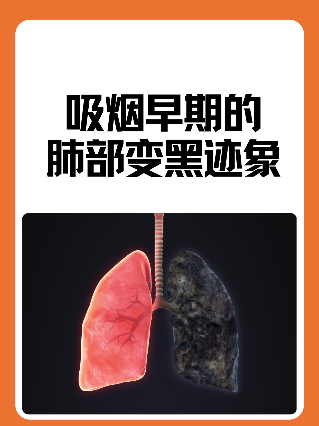 吸烟早期的肺部变黑迹象