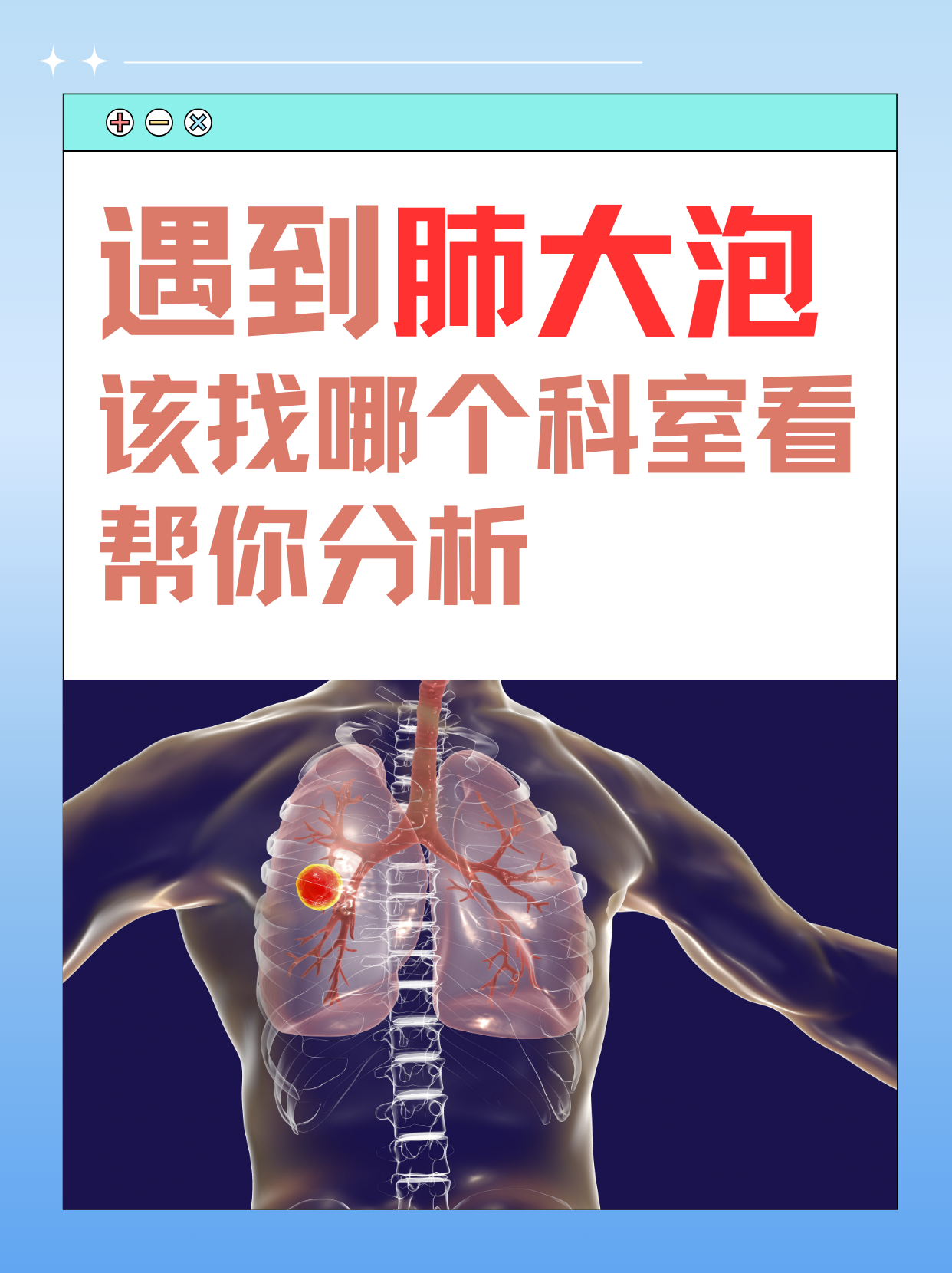 遇到肺大泡，该找哪个科室看？帮你分析！