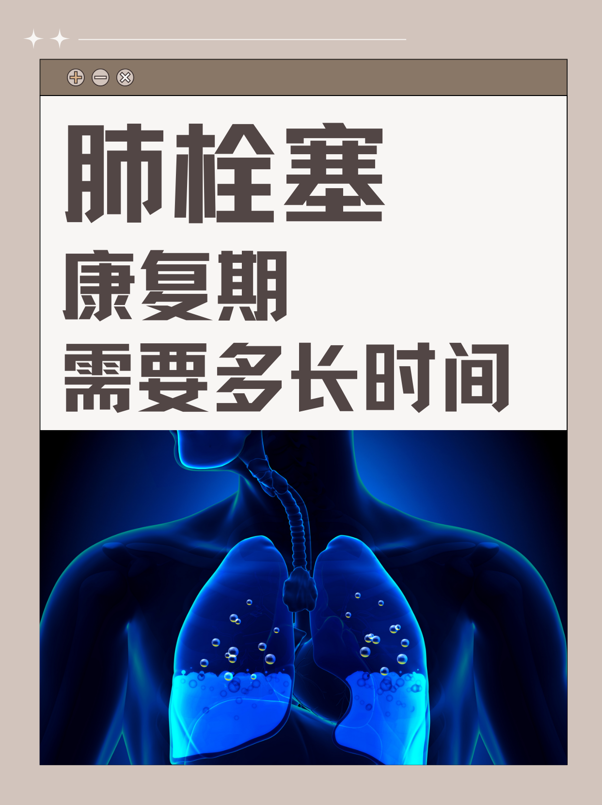 肺栓塞康复期需要多长时间？关键在这三点