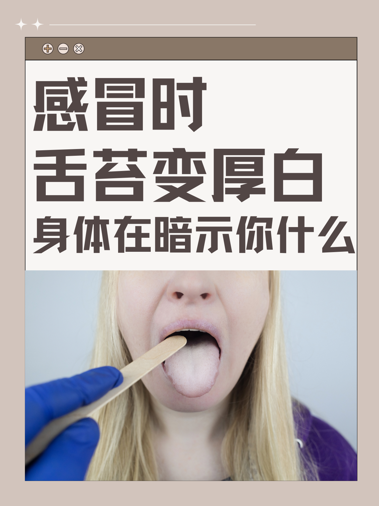 感冒时舌苔变厚白，身体在暗示你什么？