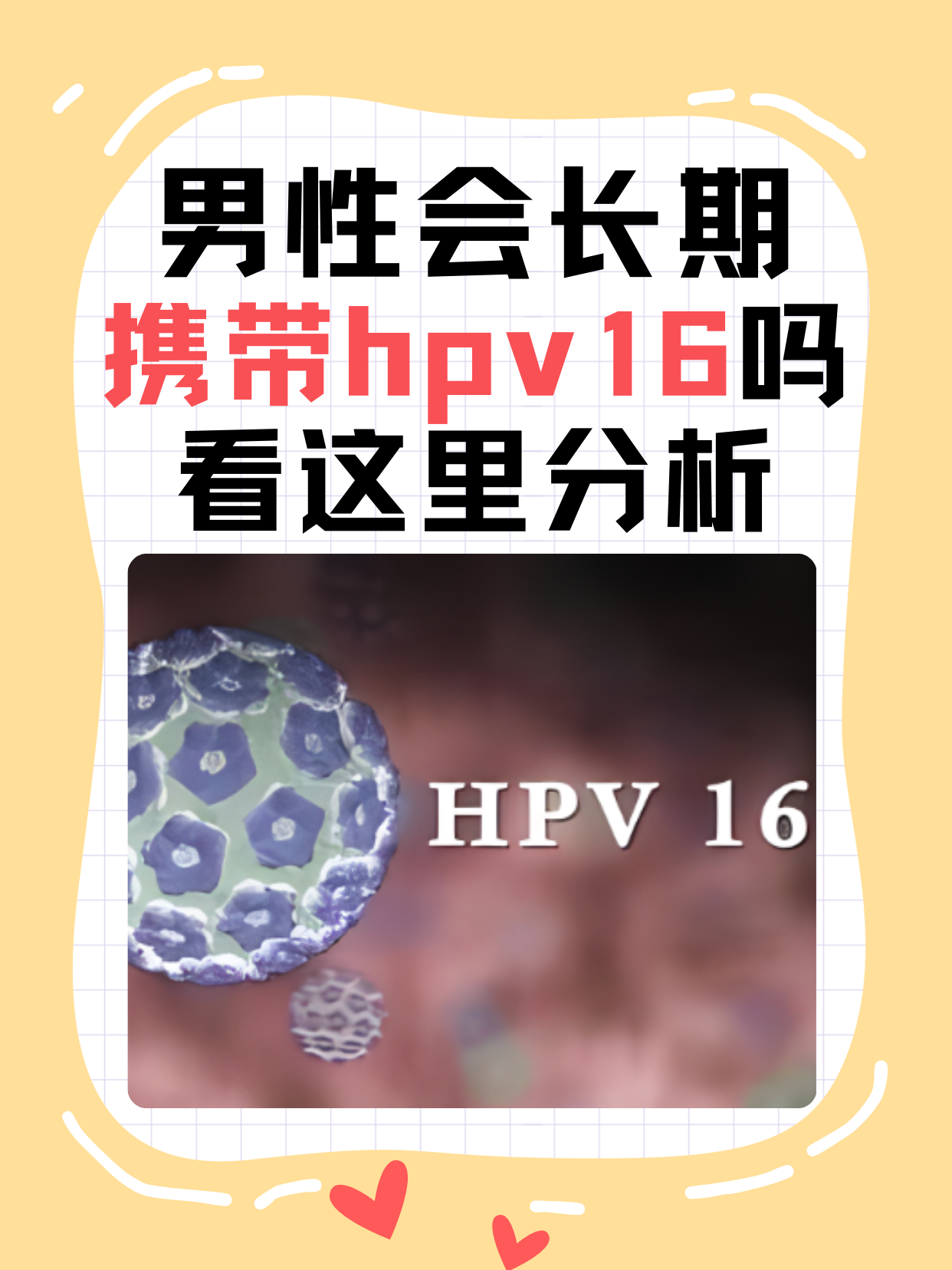 男性会长期携带hpv16吗，看这里分析