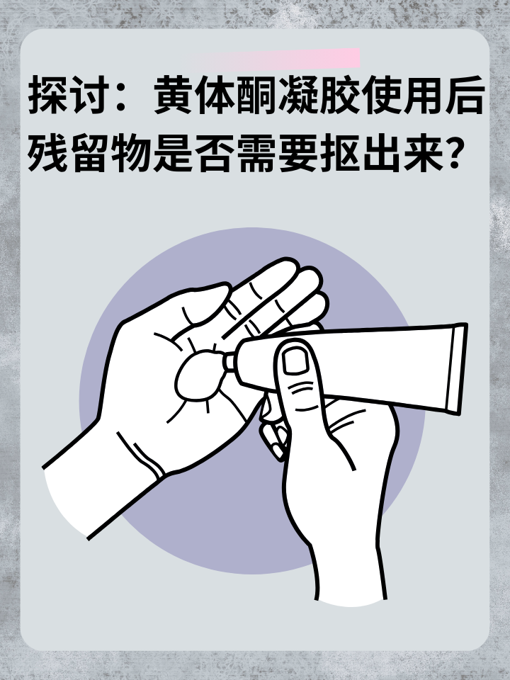 探讨：黄体酮凝胶使用后残留物是否需要抠出来？