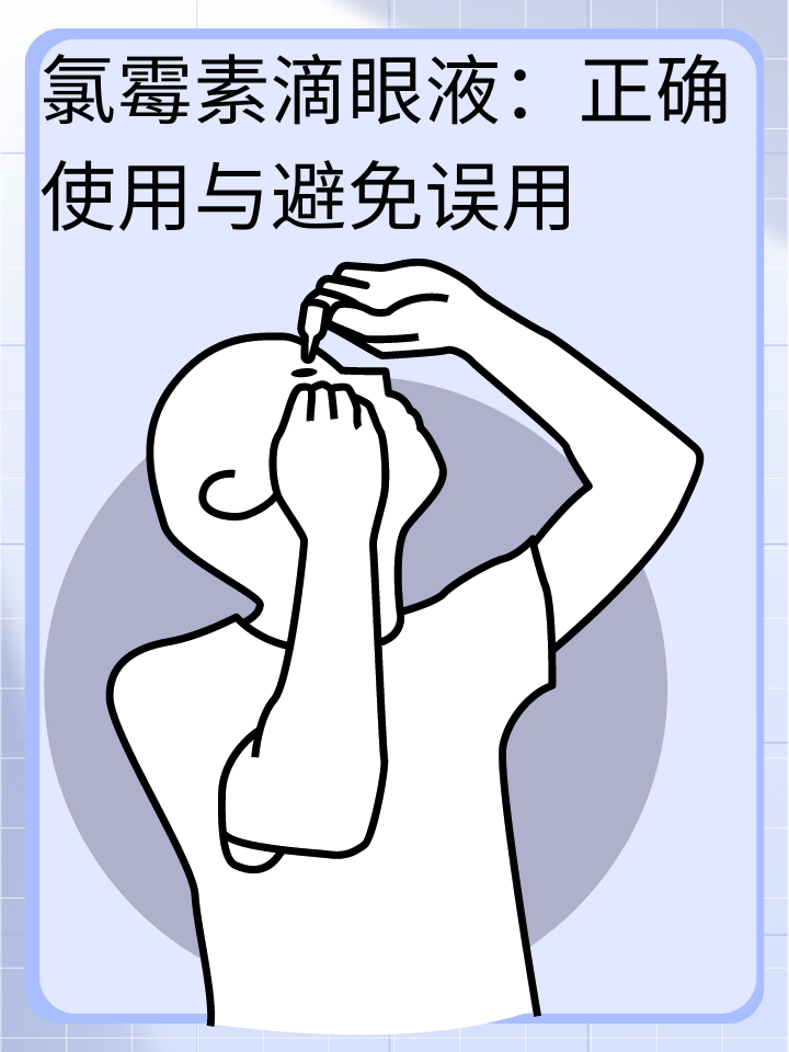 氯霉素滴眼液：正确使用与避免误用