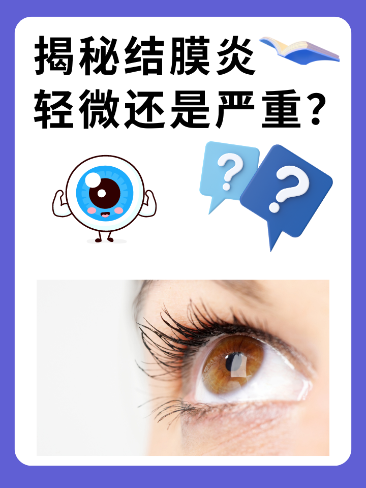 揭秘结膜炎：轻微还是严重？