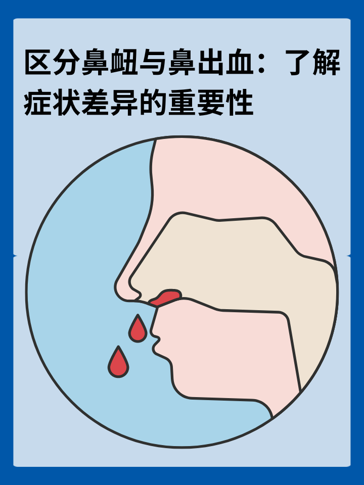 区分鼻衄与鼻出血：了解症状差异的重要性