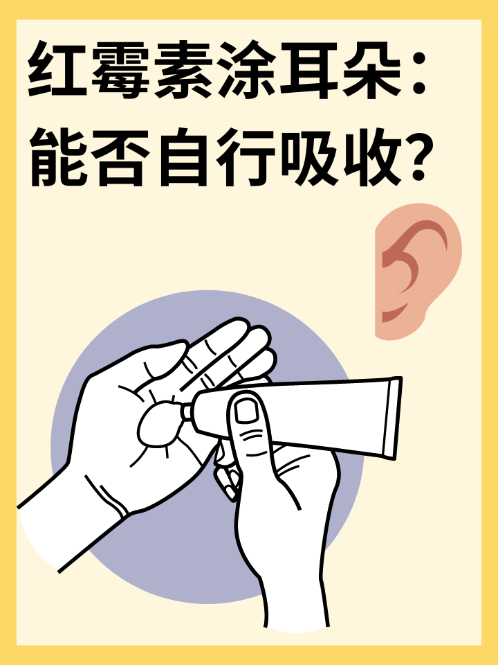 红霉素涂耳朵：能否自行吸收？