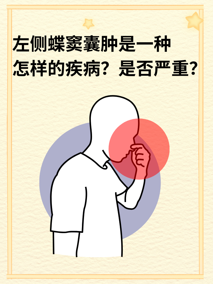 左侧蝶窦囊肿是一种怎样的疾病？是否严重？