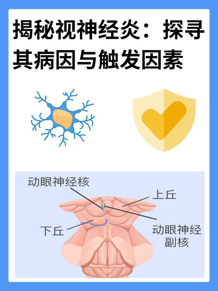 揭秘视神经炎：探寻其病因与触发因素