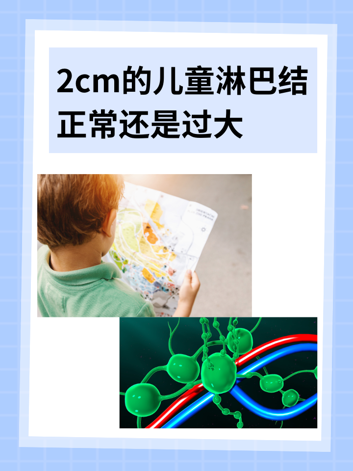 2cm的儿童淋巴结：正常还是过大？