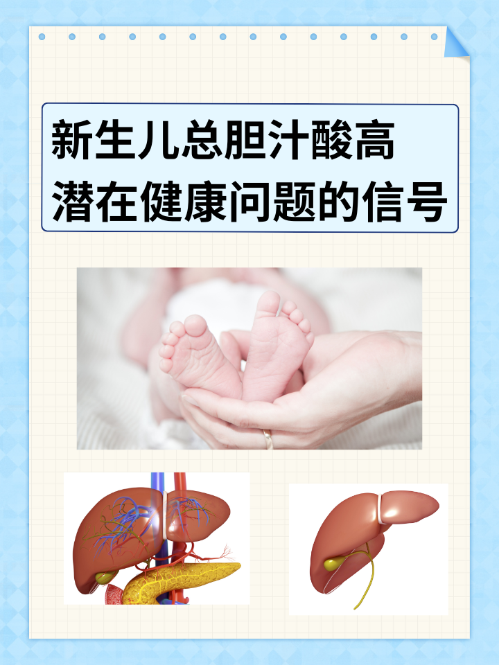 新生儿总胆汁酸高：潜在健康问题的信号