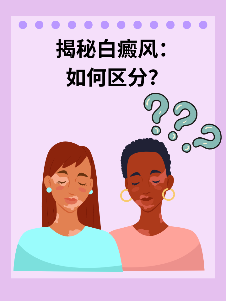 揭秘白癜风：如何区分？