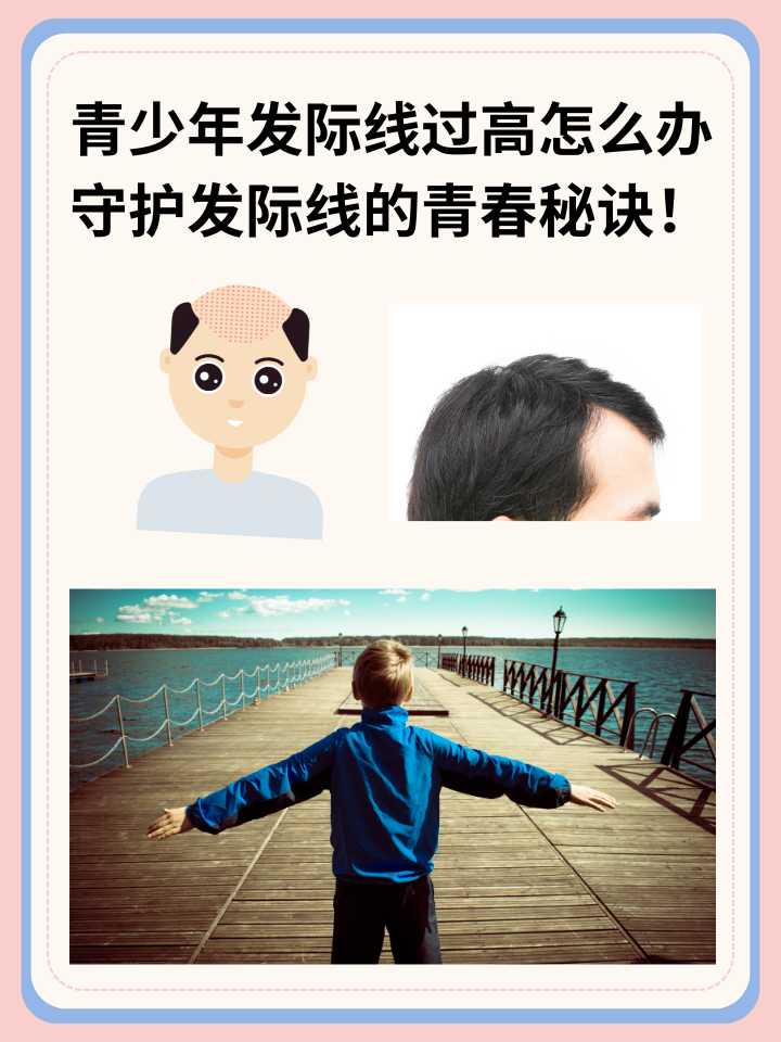 青少年发际线过高怎么办？守护发际线的青春秘诀！